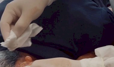 PREFEITURA DE TRINDADE INICIA REALIZAÇÃO DE PEQUENAS CIRURGIAS EM UNIDADES BÁSICAS DE SAÚDE